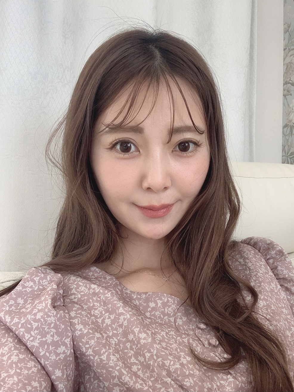 ハイフの効果や持続期間 効果を高める方法を解説 他施術との併用症例も紹介 ハイフの効果や持続期間 効果を高める方法を解説 他施術との併用症例も紹介