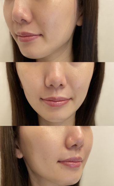 sublime様専用　ゼオスキンヘルス5点セット sublime様専用 ゼオスキンヘルス5点セット まり様専用♪ クレンジング