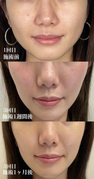 トリニティプラスの効果って？副作用はある？経過(症例)も紹介！