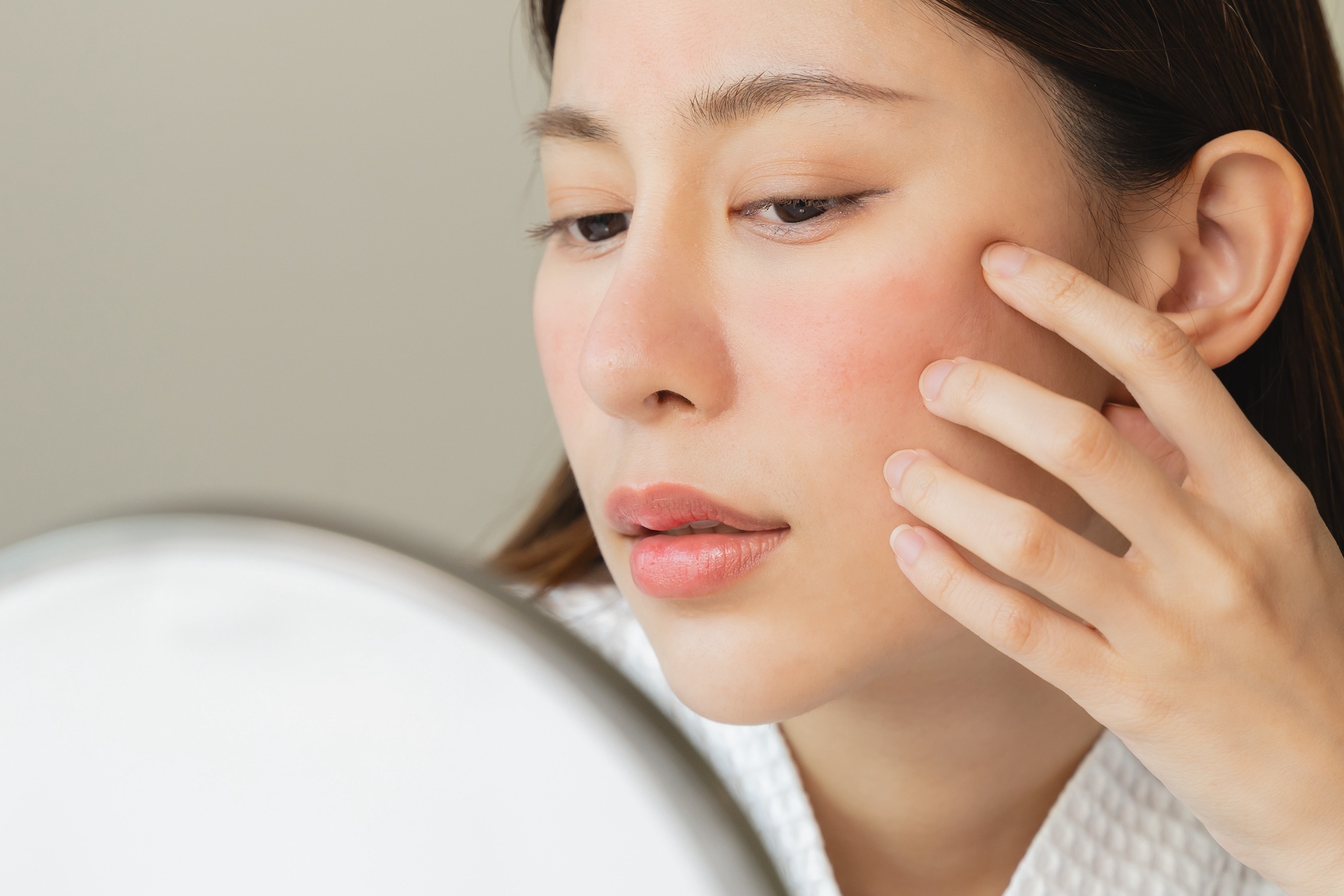 肌の赤みに悩む女性