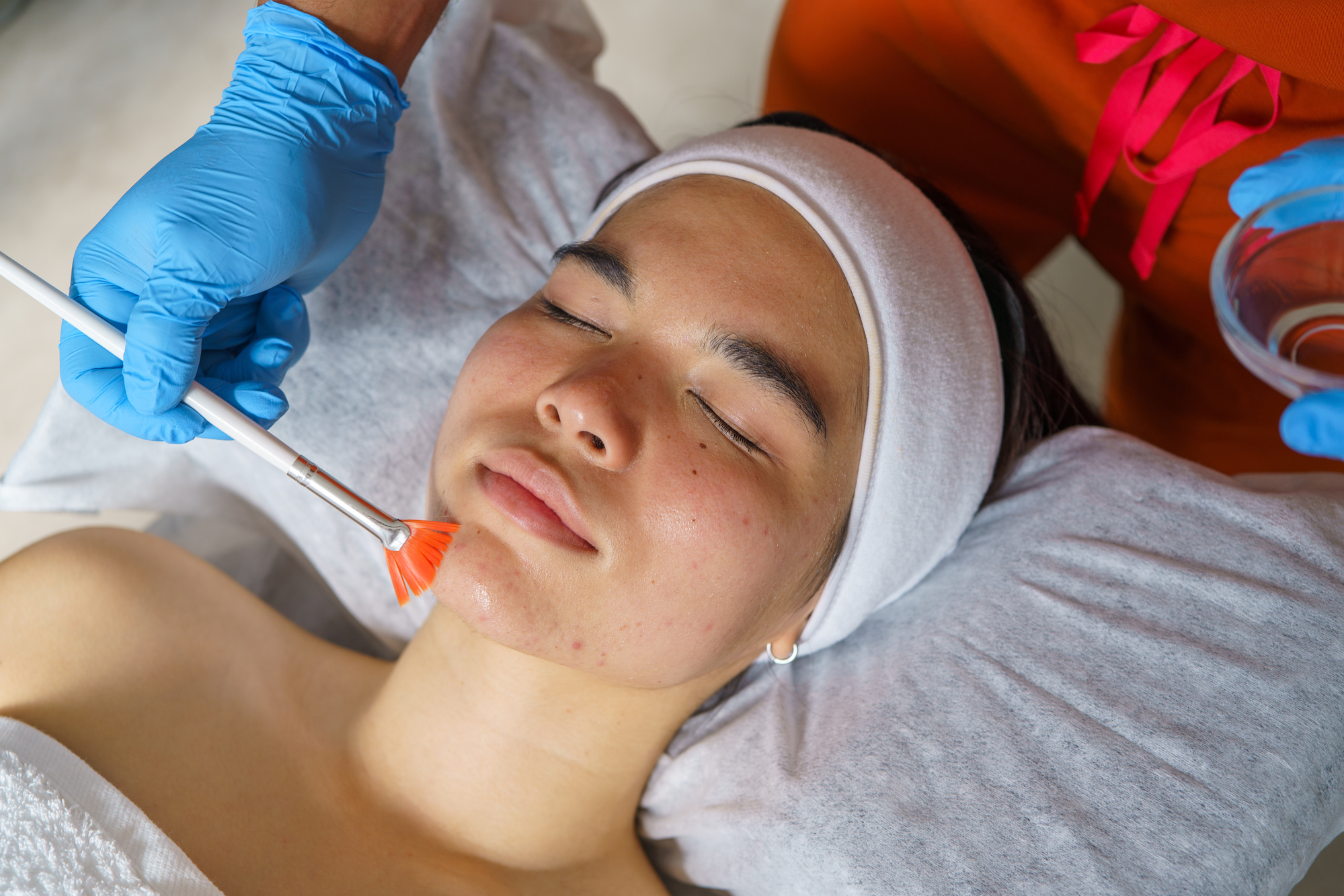 ピーリングを受ける女性