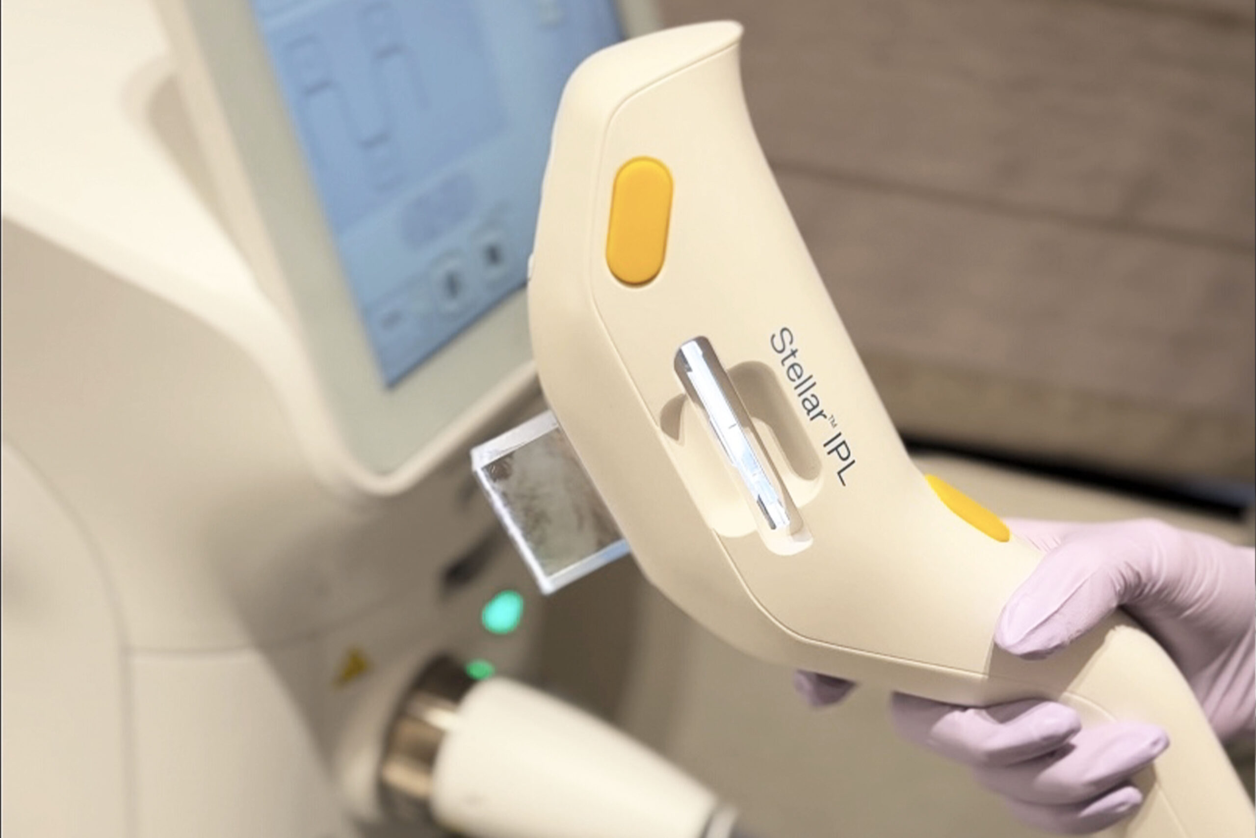 ステラM22の写真