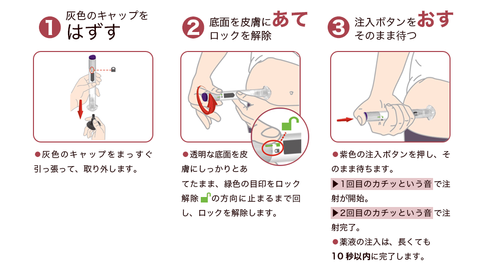 アテオスの使い方