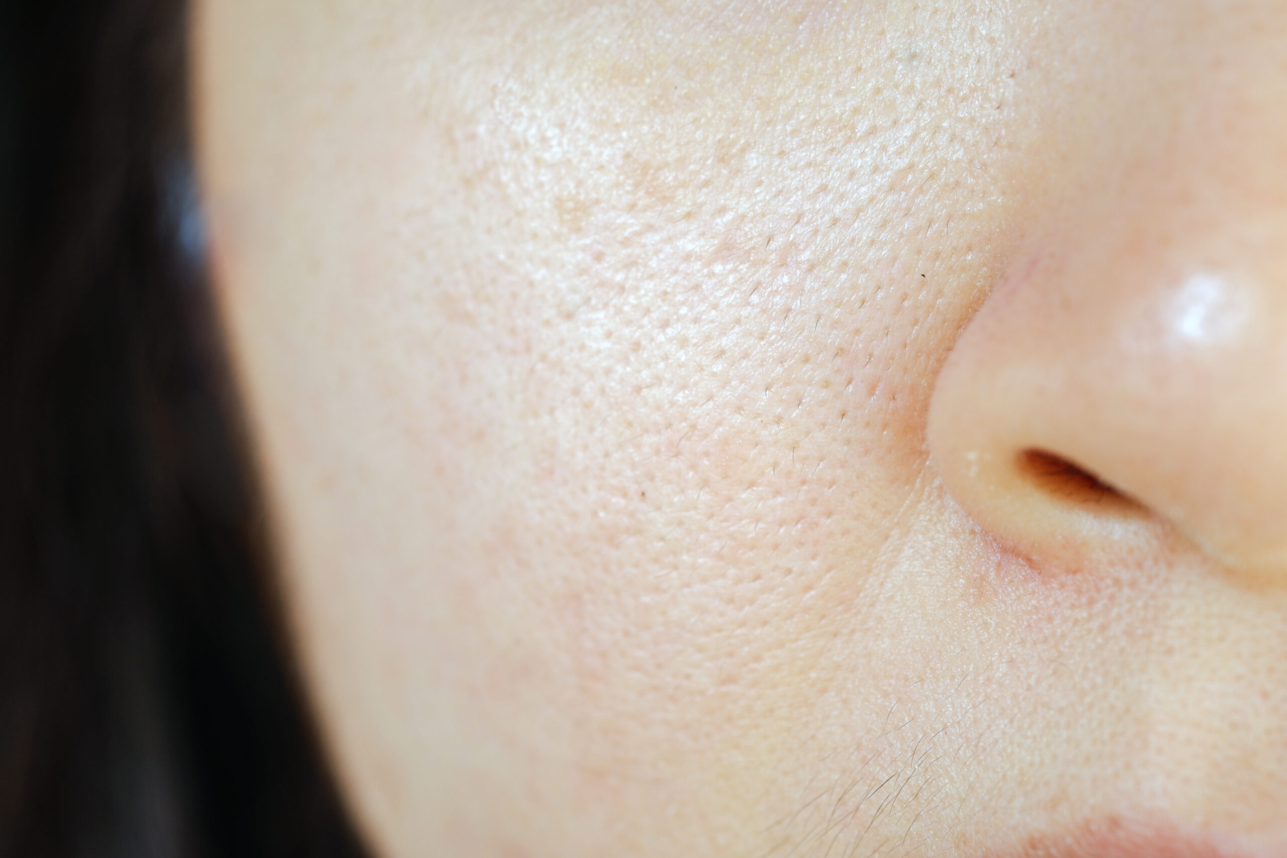 頬の毛穴のアップ