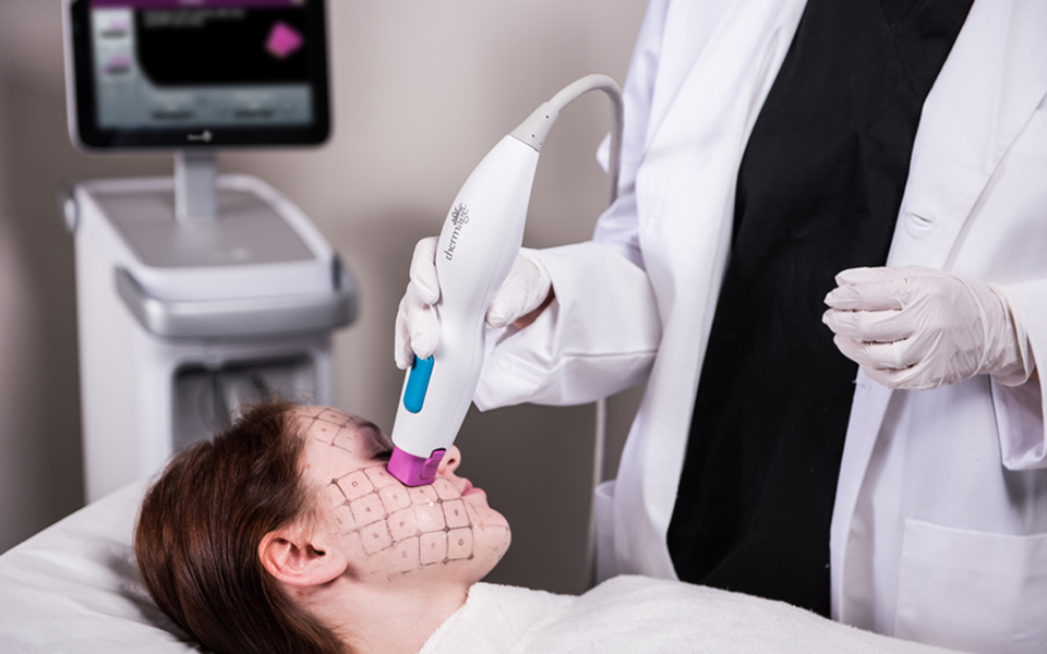 サーマクール施術の写真