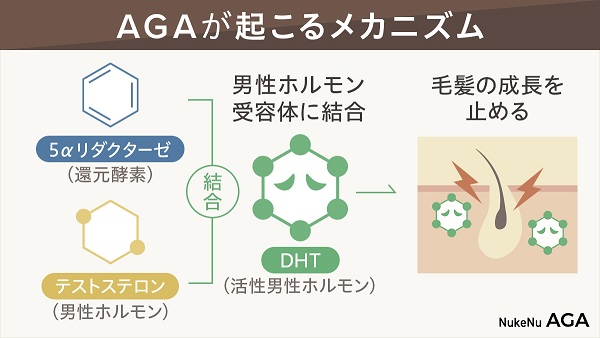 AGAが起こるメカニズム
