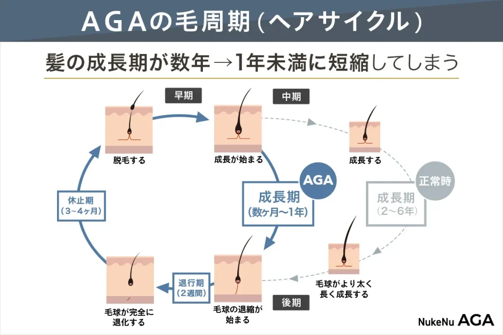 効果的な薄毛対策を医師が解説する記事