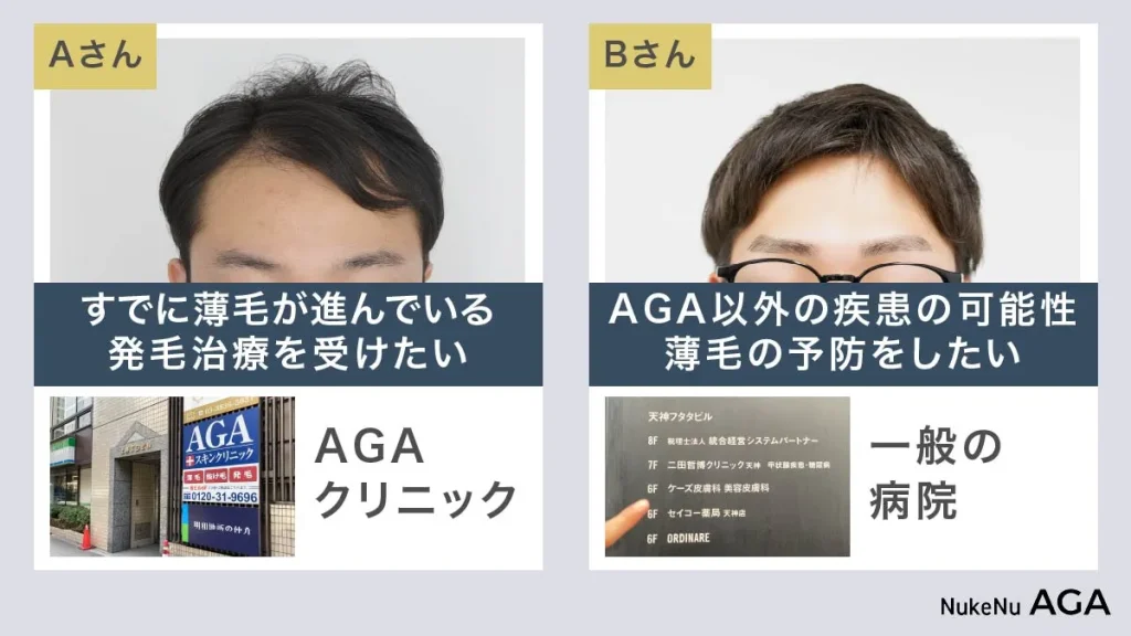 AGAクリニックがおすすめの人,皮膚科がおすすめの人