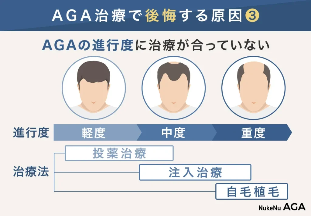 AGA治療で後悔する原因③薄毛の進行度と治療があっていない