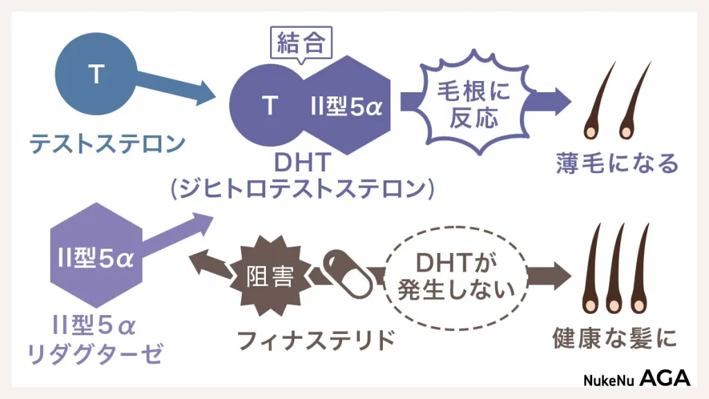 AGAの仕組みとフィナステリドの効果