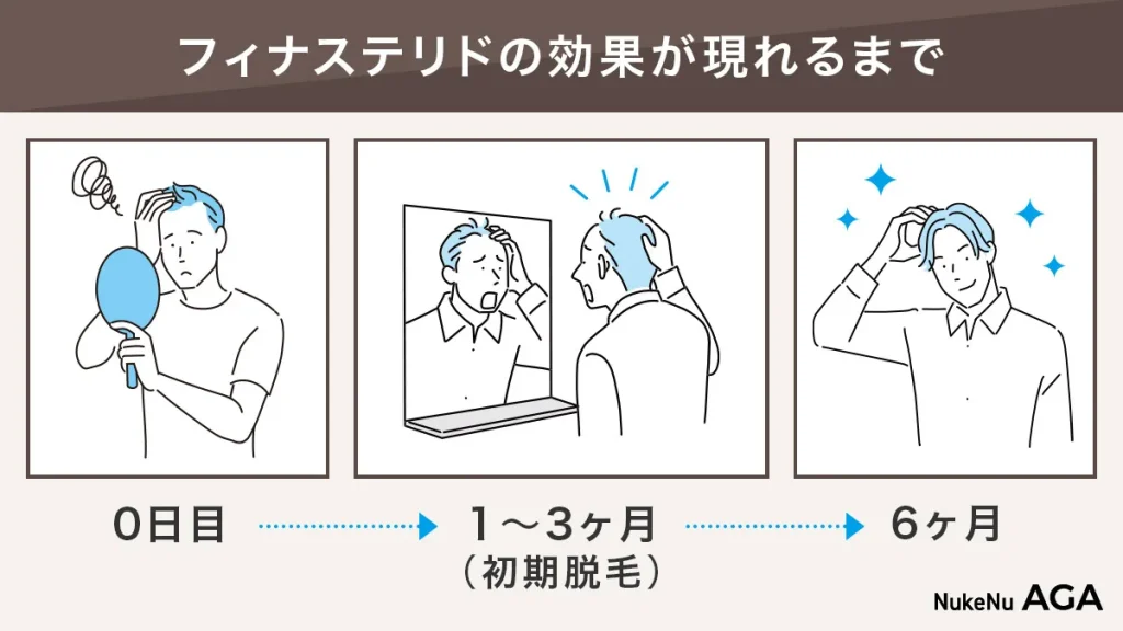 フィナステリドの効果を感じるまでの期間