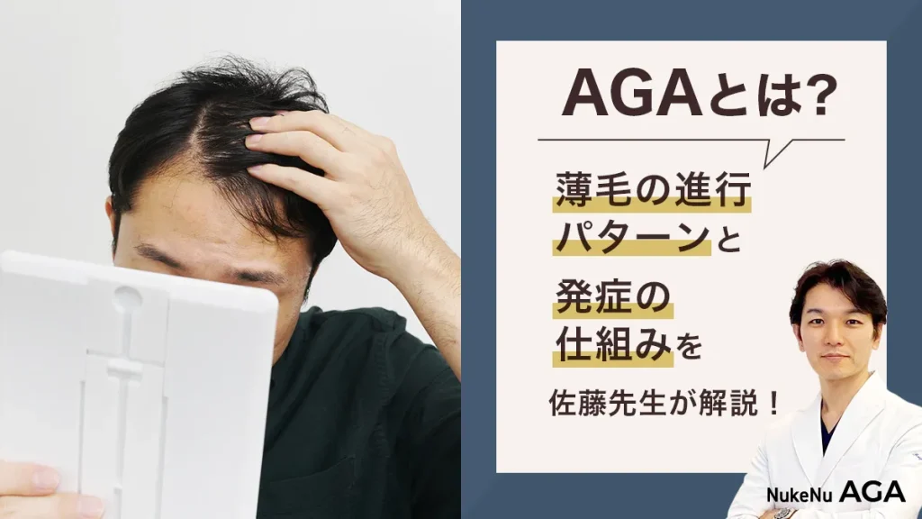 AGA,薄毛,M字ハゲ,U字ハゲ,O字ハゲ,見分け方