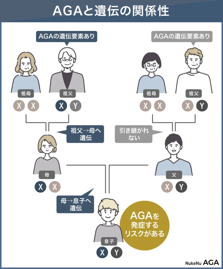 AGA,薄毛,遺伝,見分け方