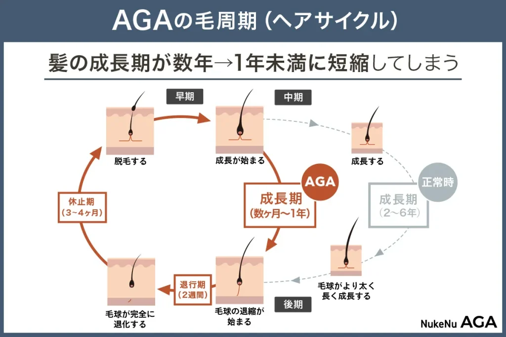 AGA,薄毛,ヘアサイクル,セルフチェック,見分け方