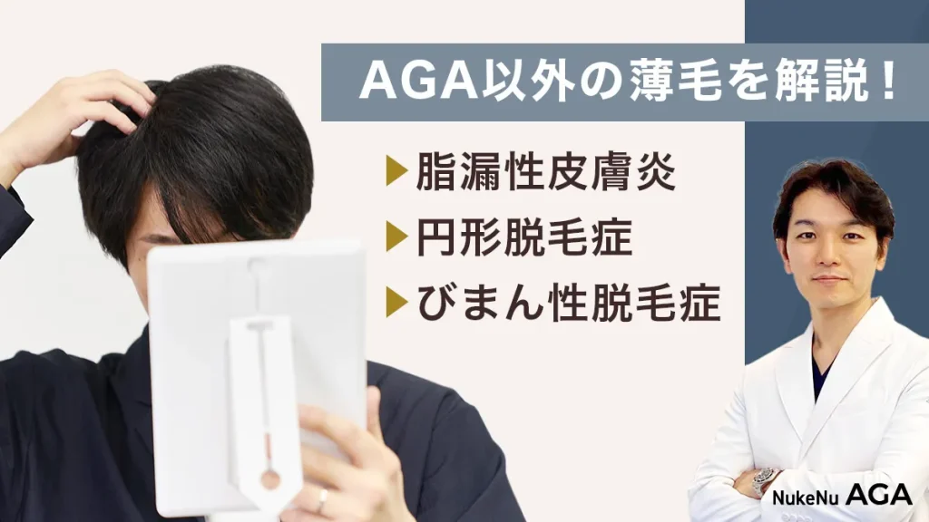 AGAじゃない,薄毛,セルフチェック,見分け方