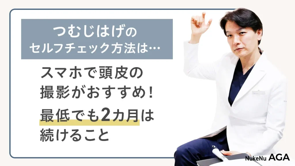 医師おすすめのつむじはげセルフチェック方法