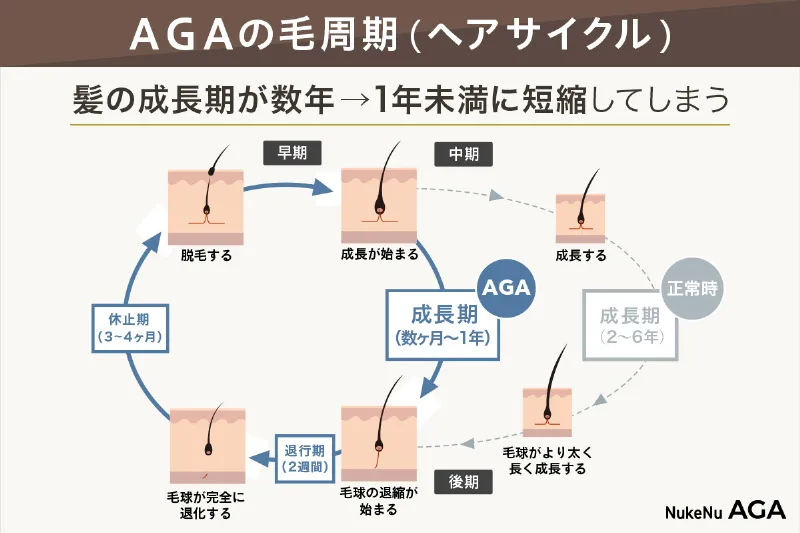 AGAのヘアサイクル