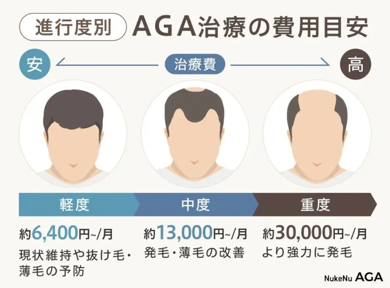 AGA治療の費用目安