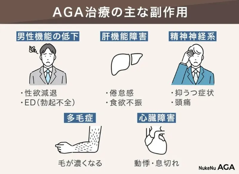 AGA治療の主な副作用