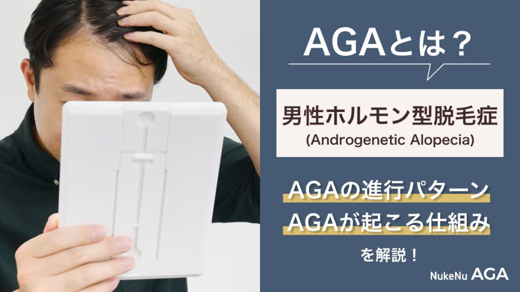 AGAとは？