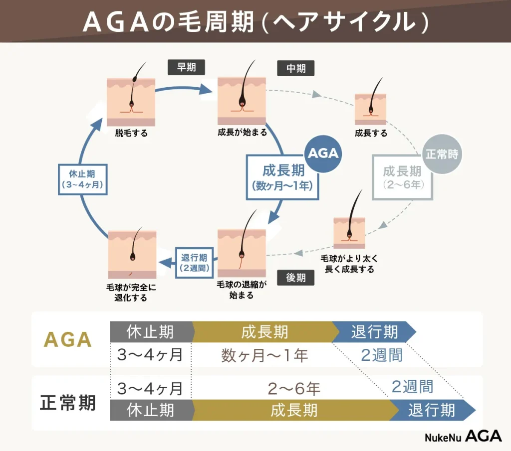 AGAの毛周期（ヘアサイクル）