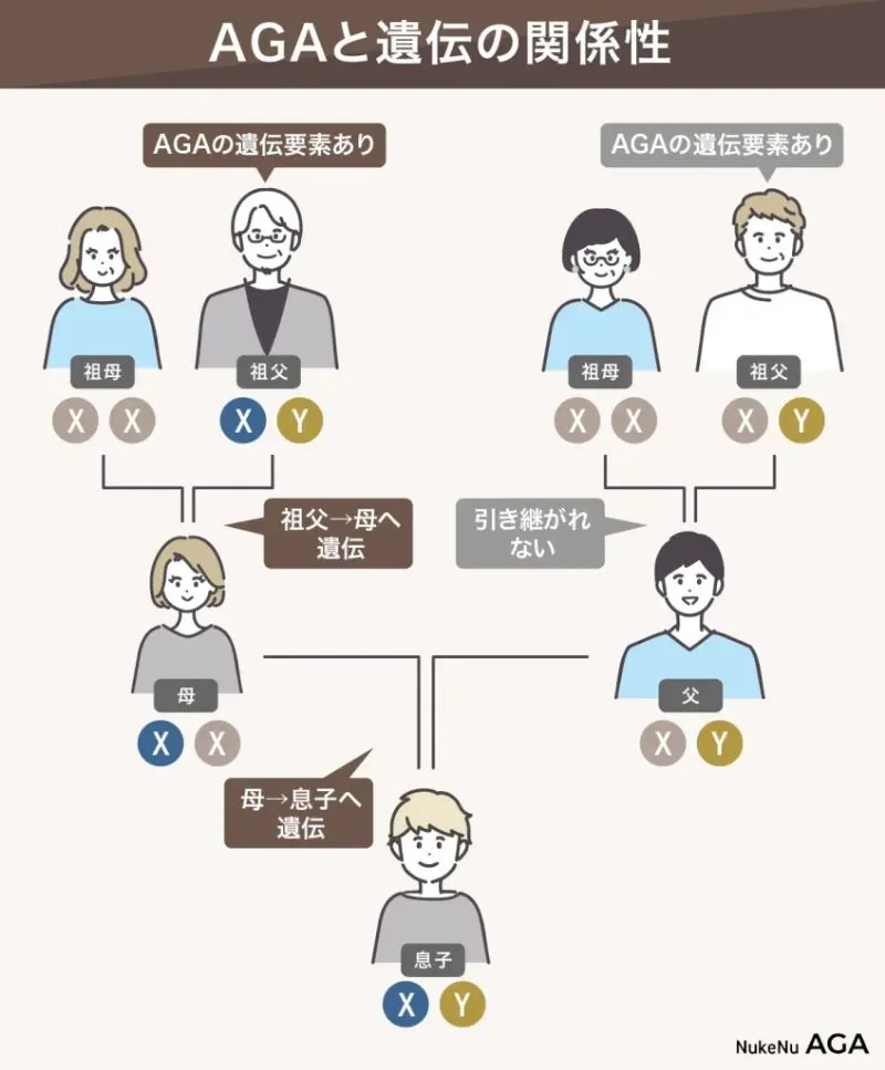AGAと遺伝の関係性